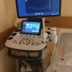 Ecografie și colonoscopie